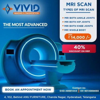 MRI Cervical Spine Center in Chanda Nagar | Vivid Imaging & Diagnostics