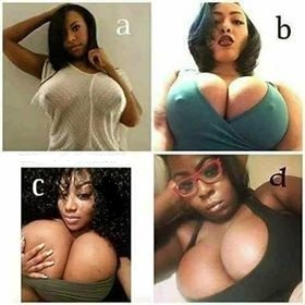 Breasts Enlargement and Reduction in Cape Town+27 74 676 7021